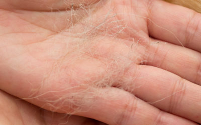 No skin-specialist available