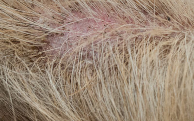 Biopsy by Dermatologist