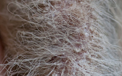 It progresses quickly now…